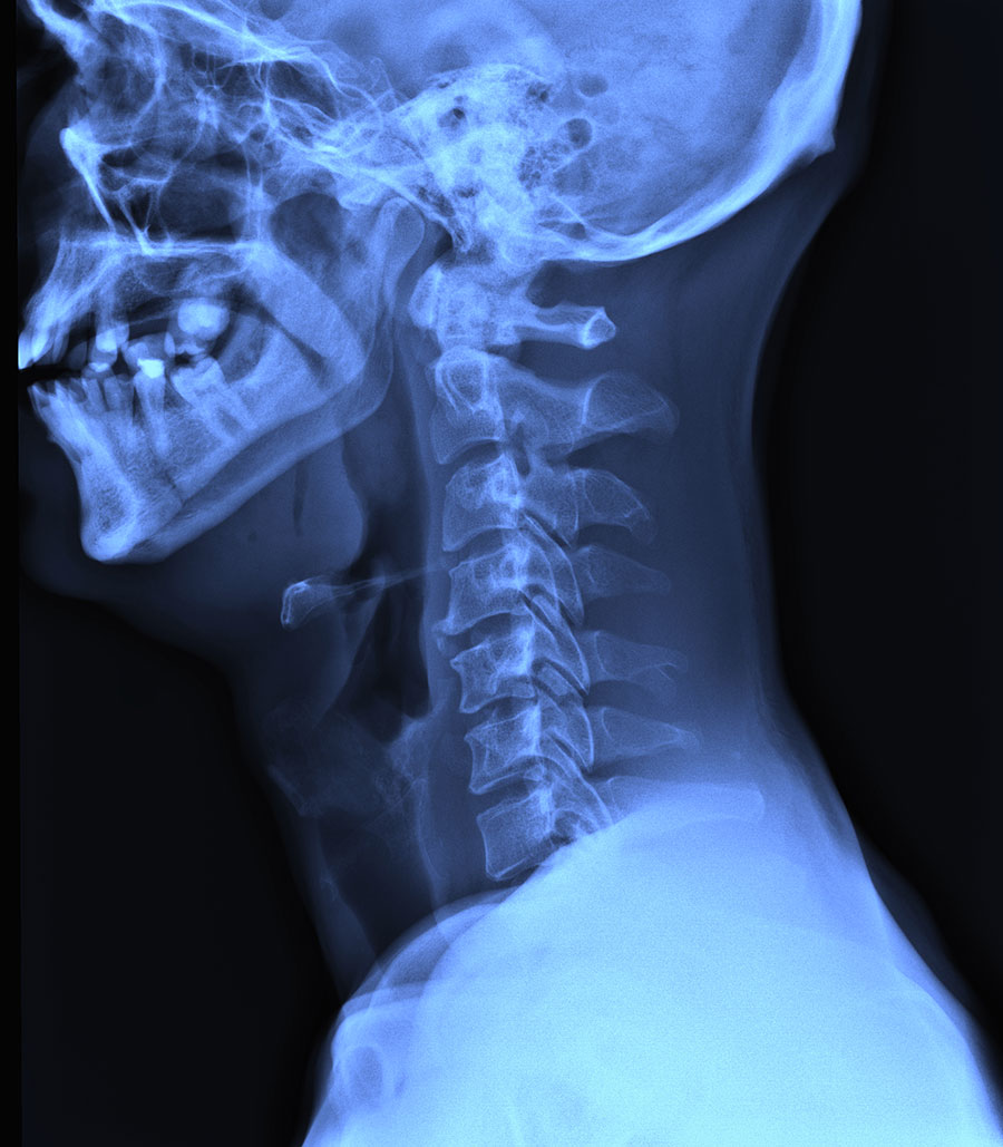 Radiographie-cephalometrique à la clinique dentaire Fréchette et Nadeau de Victoriaville.