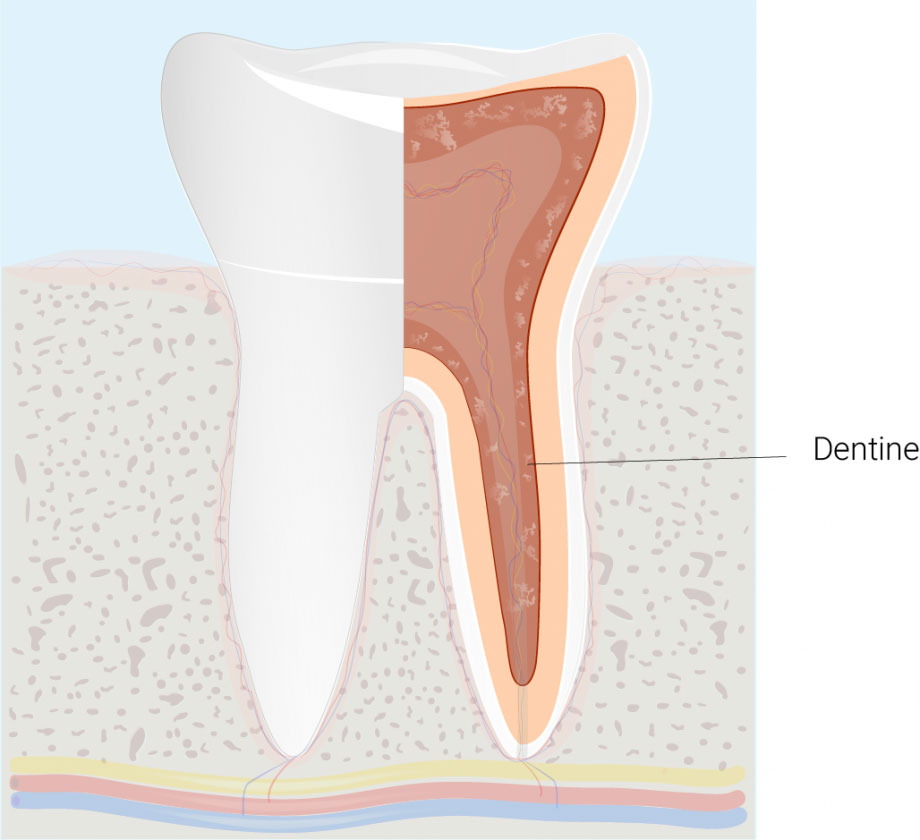 La dentine forme la majeure partie de la dent
