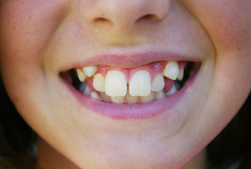 Sourire